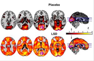Brain on LSD.jpg