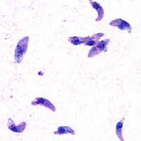 Toxoplasma gondii tachy.jpg