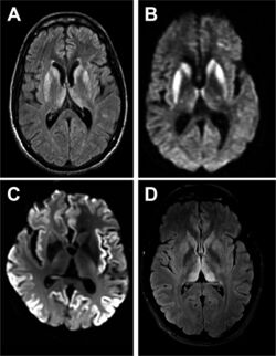 Practneurol-2016-001571f02.jpg